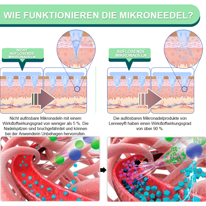 【Letzter Tag – 60 % RABATT 💓】Lenreey® NIDDK-Tirzepatid Schlankheits- & Gesundheits-NANO-MIKRONEDEL-PFLASTER 🇩🇪 (Kein Schmerz, 24/7 Wirkstofffreisetzung | Schnell 9 kg verlieren | 90 % Blutzuckersenkung) 🐅🏹