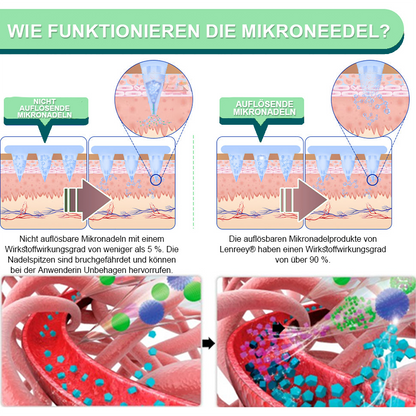 【Letzter Tag – 60 % RABATT 💓】Lenreey® NIDDK-Tirzepatid Schlankheits- & Gesundheits-NANO-MIKRONEDEL-PFLASTER 🇩🇪 (Kein Schmerz, 24/7 Wirkstofffreisetzung | Schnell 9 kg verlieren | 90 % Blutzuckersenkung) 🐅🏹